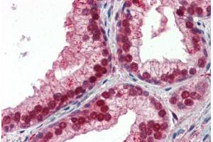 Human Prostate (formalin-fixed, paraffin-embedded) stained with NFIX antibody ABIN462183 followed by biotinylated goat anti-rabbit IgG secondary antibody ABIN481713, alkaline phosphatase-streptavidin and chromogen. (NFIX antibody  (AA 181-230))