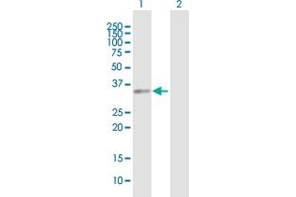 NACA antibody  (AA 1-215)