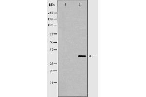 Western blot analysis of Hepg2 whole cell lysates, using TPM1  Antibody.