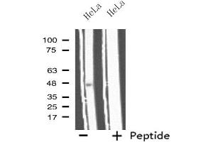 Western blot analysis of extracts from HeLa cells, using IL11RA antibody. (IL11RA antibody  (C-Term))