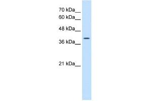 WNT2B antibody used at 0. (WNT2B antibody  (N-Term))