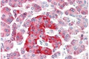 Human Pancreas: Formalin-Fixed, Paraffin-Embedded (FFPE) (KCNMA1 antibody  (Gln770))