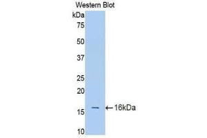 Western Blotting (WB) image for anti-Interleukin 18 Receptor 1 (IL18R1) (AA 147-255) antibody (ABIN1174878)
