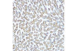 Immunohistochemistry of paraffin-embedded human liver using CPS1 Rabbit mAb (ABIN7266063) at dilution of 1:100 (40x lens). (CPS1 antibody)