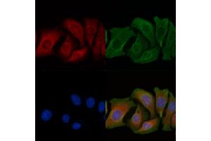 ABIN6263429 and ABIN6266804 staining Hela cells by IF/ICC.