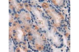 #VALUE! (Hexokinase 1 antibody  (AA 80-215))