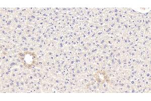Detection of GCK in Mouse Liver Tissue using Polyclonal Antibody to Glucokinase (GCK) (GCK antibody  (AA 3-226))