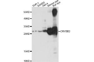 Western blot analysis of extracts of various cell lines,ing CRYBB2 antibody (ABIN1876777) at 1:1000 dilution. (CRYbB2 antibody)