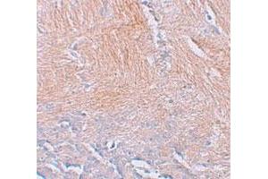 Immunohistochemical staining of human brain cells with CXXC5 polyclonal antibody  at 2. (CXXC5 antibody  (N-Term))