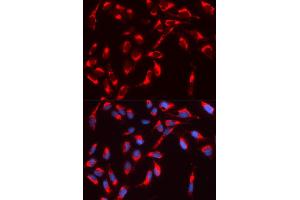 Immunofluorescence (IF) image for anti-Neural Wiskott-Aldrich syndrome protein (WASL) antibody (ABIN1875345) (Neural Wiskott-Aldrich syndrome protein (WASL) antibody)