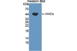 Detection of Recombinant TCN1, Human using Polyclonal Antibody to Transcobalamin I (TCN1) (TCN1 antibody  (AA 24-433))