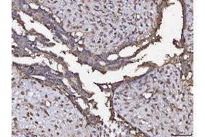 IHC analysis of ANXA4 using anti-ANXA4 antibody (ABIN5518805). (Annexin IV antibody  (Middle Region))