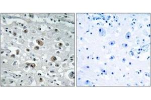 Immunohistochemistry analysis of paraffin-embedded human brain tissue, using GASP1 Antibody.