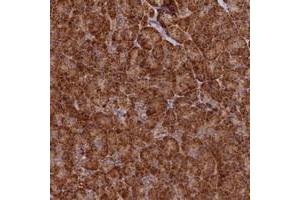 Immunohistochemical staining of human pancreas with DNAH10 polyclonal antibody  shows strong cytoplasmic positivity in exocrine glandular cells at 1:200-1:500 dilution.