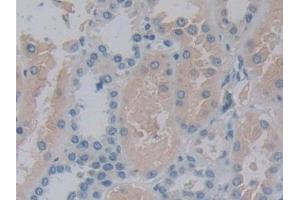 Detection of 15-LO-2 in Human Kidney Tissue using Polyclonal Antibody to 15-Lipoxygenase-2 (15-LO-2) (ALOX15B antibody  (AA 253-490))