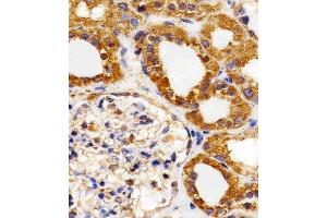 Paraformaldehyde-fixed, paraffin embedded Human Kidney tissue, Antigen retrieval by boiling in sodium citrate buffer (pH6. (FLT4 antibody)