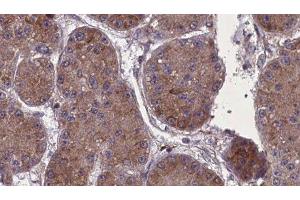 ABIN6277715 at 1/100 staining Human kidney tissue by IHC-P. (Nephrin antibody)