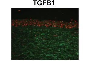 Species, Tissue/Cell Type:Human Cornea tissue (epithelium and stroma) Primary used and dilution: 1:400 (TGFBI antibody  (C-Term))