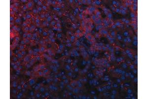 anti-Protein tyrosine Phosphatase, Receptor Type, J (PTPRJ) (AA 143-891) antibody