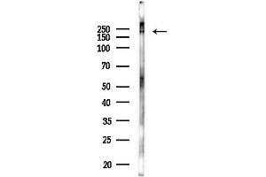 Western blot analysis of lysates from Hela cells(LPS 4h treatment), using TANC2 Antibody at 1/1000 dilution. (TANC2 antibody)