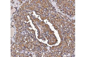 IHC analysis of GPR54/KISS1R using anti-GPR54/KISS1R antibody (ABIN7602153). (KISS1R antibody  (AA 60-373))