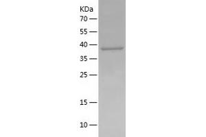 CCRL2 Protein (AA 171-344) (His-IF2DI Tag)