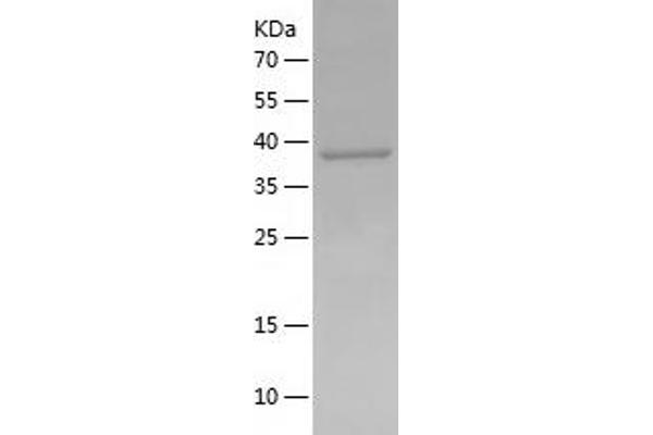 CCRL2 Protein (AA 171-344) (His-IF2DI Tag)