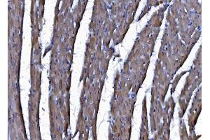 IHC analysis of CHCHD10 using anti-CHCHD10 antibody (ABIN7602507). (CHCHD10 antibody  (AA 80-142))