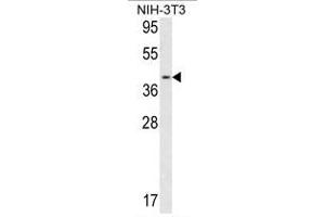 Image no. 1 for anti-Calponin 3, Acidic (CNN3) (Middle Region) antibody (ABIN452801) (CNN3 antibody  (Middle Region))