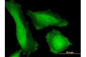 Immunofluorescence of purified MaxPab antibody to TPD52 on HeLa cell. (TPD52 antibody  (AA 1-184))