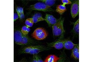 Immunofluorescence (IF) image for anti-BCL2-Like 1 (BCL2L1) (pSer62) antibody (ABIN3020106) (BCL2L1 antibody  (pSer62))