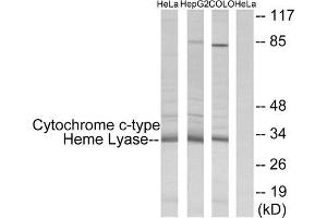 Western Blotting (WB) image for anti-Holocytochrome C Synthase (HCCS) (Internal Region) antibody (ABIN6300069) (HCCS antibody  (Internal Region))