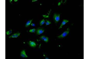 Immunofluorescence staining of U251 cells with ABIN7161318 at 1:200, counter-stained with DAPI. (Neuroligin 3 antibody  (AA 642-783))