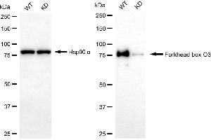 Western blotting analysis using forkhead box O3 antibody (ABIN7798646). (Recombinant FOXO3 antibody)