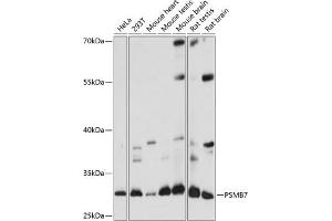 Western blot analysis of extracts of various cell lines, using PSMB7 antibody (ABIN7269594) at 1:1000 dilution. (PSMB7 antibody  (AA 44-200))