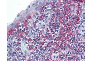 LIN7C antibody was used for immunohistochemistry at a concentration of 4-8 ug/ml. (LIN7C antibody)