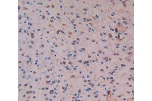 Used in DAB staining on fromalin fixed paraffin-embedded Liver tissue (MST1 antibody  (AA 469-704))