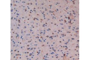 Used in DAB staining on fromalin fixed paraffin-embedded Liver tissue (MST1 antibody  (AA 469-704))