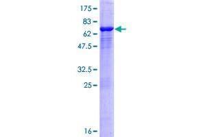 ASCC1 Protein (AA 1-357) (GST tag)