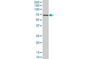 CHEK2 monoclonal antibody (M02), clone 6B8 Western Blot analysis of CHEK2 expression in Jurkat . (CHEK2 antibody  (AA 1-100))