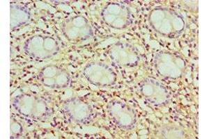 Immunohistochemistry of paraffin-embedded human colon tissue using ABIN7147595 at dilution of 1:100