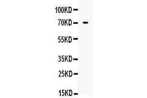 Western blot analysis of Angiopoietin-1 using anti-Angiopoietin-1 antibody . (Angiopoietin 1 antibody  (Middle Region))