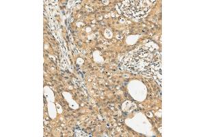 Immunohistochemistry (Paraffin-embedded Sections) (IHC (p)) image for anti-Mast/stem Cell Growth Factor Receptor (KIT) (AA 912-941) antibody (ABIN392009)