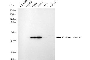 Western blotting analysis using creatine kinase B antibody (ABIN7798163).