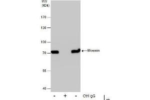 IP Image Immunoprecipitation of Moesin protein from A431 whole cell extracts using 5 μg of Moesin antibody [C2C3], C-term, Western blot analysis was performed using Moesin antibody [C2C3], C-term, EasyBlot anti-Rabbit IgG  was used as a secondary reagent. (Moesin antibody  (C-Term))