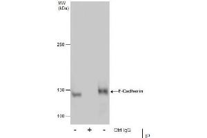 Immunoprecipitation (IP) image for anti-Cadherin 1, Type 1, E-Cadherin (Epithelial) (CDH1) antibody (ABIN2854751)