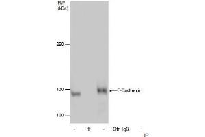 IP Image Immunoprecipitation of E-Cadherin protein from MCF-7 whole cell extracts using 5 μg of E-Cadherin antibody, Western blot analysis was performed using E-Cadherin antibody, EasyBlot anti-Rabbit IgG  was used as a secondary reagent. (E-cadherin antibody)