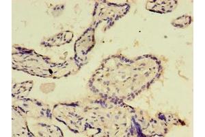 Immunohistochemistry of paraffin-embedded human placenta tissue using ABIN7172517 at dilution of 1:100 (E2F2 antibody  (AA 1-83))