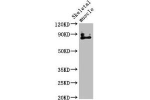 Western Blot Positive WB detected in: Mouse skeletal muscle tissue All lanes: TRPV2 antibody at 4. (TRPV2 antibody  (AA 1-117))