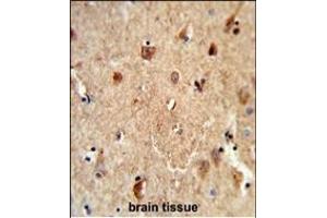 Formalin-fixed and paraffin-embedded human brain tissue reacted with CES7 Antibody (Center), which was peroxidase-conjugated to the secondary antibody, followed by DAB staining. (CES5A antibody  (AA 244-270))